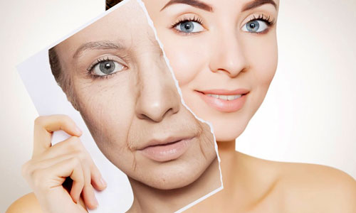 Anti Aging